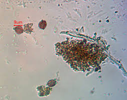 Attēlu rezultāti vaicājumam “Diderma testaceum sessile”