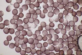 Attēlu rezultāti vaicājumam “Microbotryum tragopogonis - pratensis”