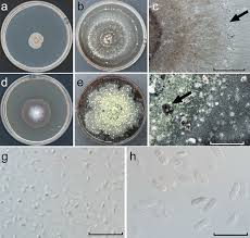 Attēlu rezultāti vaicājumam “Heyderia pusilla”