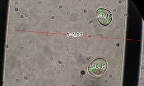 Attēlu rezultāti vaicājumam “Enteridium liceoides spores”