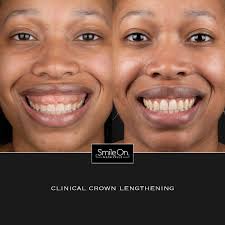 Bildergebnis für smile