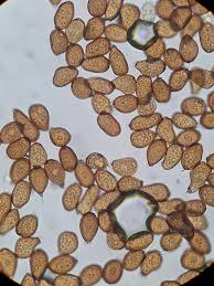 Attēlu rezultāti vaicājumam “Lycogala roseosporum spores”
