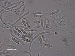 Attēlu rezultāti vaicājumam “Coenogonium pineti”
