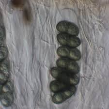 Attēlu rezultāti vaicājumam “Physconia distorta”