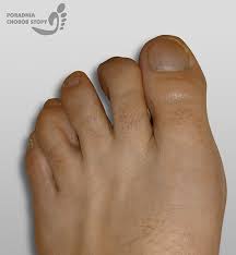 Znalezione obrazy dla zapytania palec