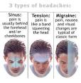 Neck Pain Support Blog: Tension, Migraine, Sinus- What a Head-
