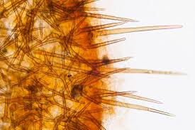 Attēlu rezultāti vaicājumam “Cheilymenia stercorea”