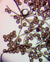 Attēlu rezultāti vaicājumam “Colloderma sp.”