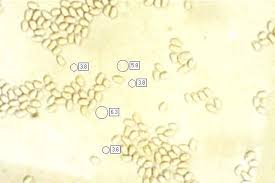 Attēlu rezultāti vaicājumam “Comatricha fragilis”