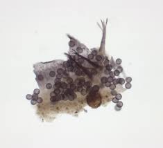 Attēlu rezultāti vaicājumam “Physarum viride var. aurantium”