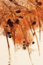 Attēlu rezultāti vaicājumam “Cheilymenia stercorea”