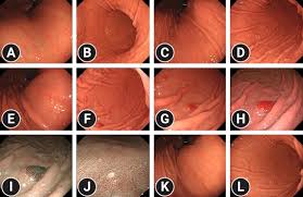 Image result for 뺾