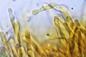 Attēlu rezultāti vaicājumam “Hemitrichia lutescens macro”