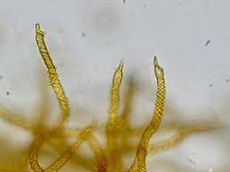 Attēlu rezultāti vaicājumam “Trichia erecta spores”