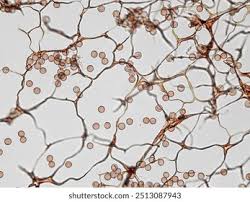 Attēlu rezultāti vaicājumam “Stemonitis flavogenita spores”