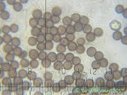 Attēlu rezultāti vaicājumam “Didymium crustaceum spores”