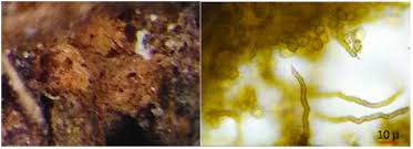 Attēlu rezultāti vaicājumam “Oligonema persimile spores”