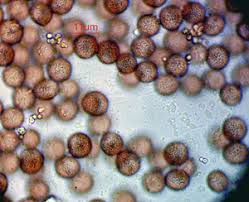 Attēlu rezultāti vaicājumam “Diderma rufostriatum spores”