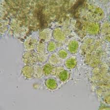 Attēlu rezultāti vaicājumam “Chaenotheca chrysocephala”