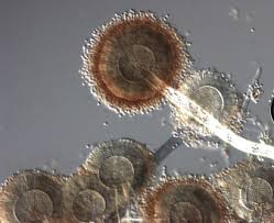 Attēlu rezultāti vaicājumam “Trichia botrytis var. cerifera spores”