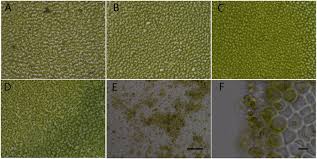 Attēlu rezultāti vaicājumam “Licea pusilla spores”