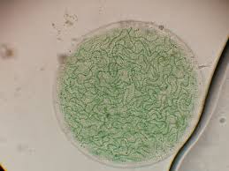 Attēlu rezultāti vaicājumam “Nostoc pruniforme cells”