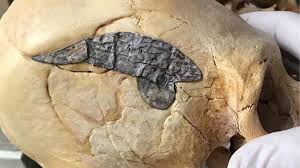 Image result for elongated skulls