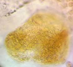 Attēlu rezultāti vaicājumam “Lycogala fuscoolearium macro”