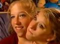 Brittany and Abigail Hensel are dicephalic parapagus twins: they have ... - 0317-hensel-twins_vg