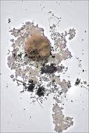 Attēlu rezultāti vaicājumam “Didymium squamulosum spores”