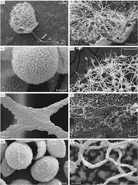 Attēlu rezultāti vaicājumam “Enerthenema papillatum spores”