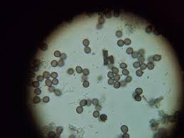 Attēlu rezultāti vaicājumam “Physarum compressum”