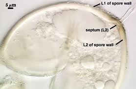 Attēlu rezultāti vaicājumam “Craterium aureum spores”