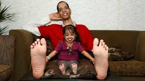 Image result for Amazing Feet Rc, Kidderminster