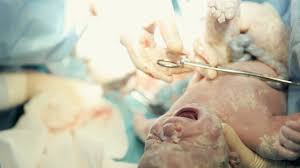 Image result for cesarskie