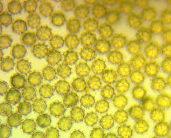 Attēlu rezultāti vaicājumam “Hemitrichia chrysospora”