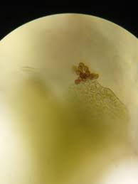 Attēlu rezultāti vaicājumam “Tritomaria exsectiformis cells”