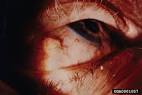 (<b>Spirurida</b>: Filariidae) -