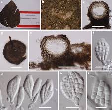 Attēlu rezultāti vaicājumam “Cribraria martinii spores”