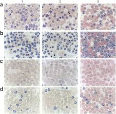 Attēlu rezultāti vaicājumam “Symphytocarpus flaccidus plasmodium”