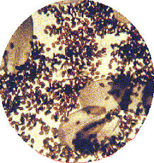 Attēlu rezultāti vaicājumam “Ochropsora ariae spores”