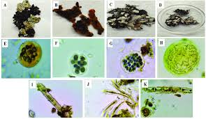 Attēlu rezultāti vaicājumam “Cetrelia sp.”