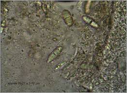 Attēlu rezultāti vaicājumam “Acrocordia gemmata”