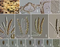 Attēlu rezultāti vaicājumam “Rosellinia desmazieri spores”