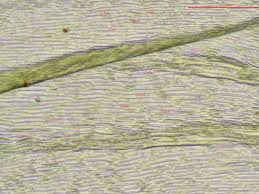 Attēlu rezultāti vaicājumam “Rhytidiadelphus subpinnatus”