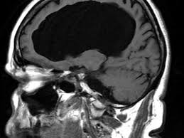 Image result for no brain