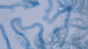 Attēlu rezultāti vaicājumam “Arcyria incarnata calyculus”