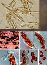 Attēlu rezultāti vaicājumam “Enteridium variabile spores”