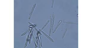 Attēlu rezultāti vaicājumam “Collaria rubens spores”