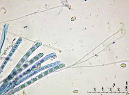 Attēlu rezultāti vaicājumam “Sowerbyella radiculata”